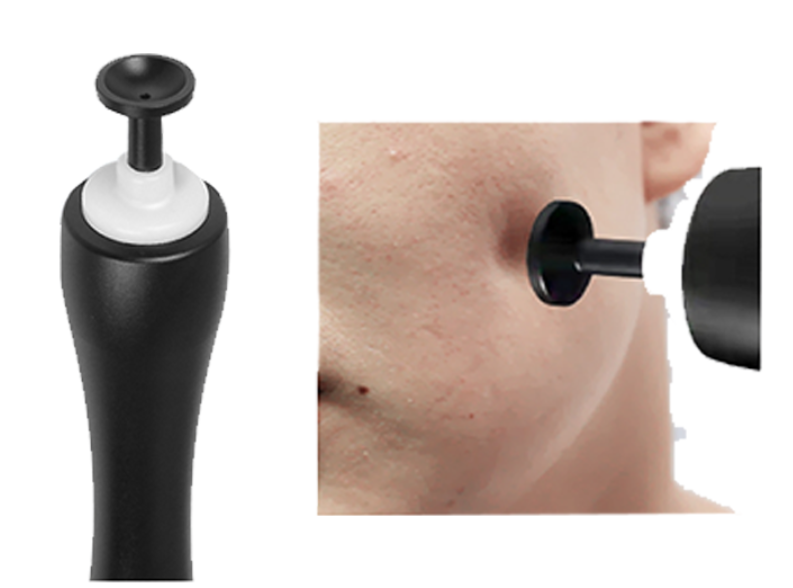 Oxygen Injection